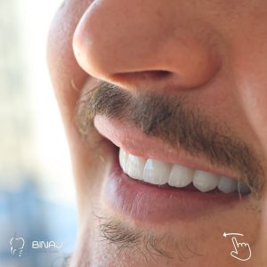 Fresh smile energy.📅 Na kontakto për më shumë informata ose për të caktuar një termin-📞 +383 4